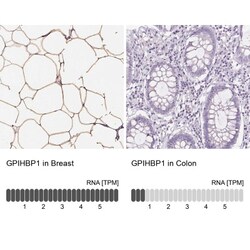 GPIHBP1 Antibody, Novus Biologicals 0.1mL; Unlabeled:Antibodies, Polyclonal